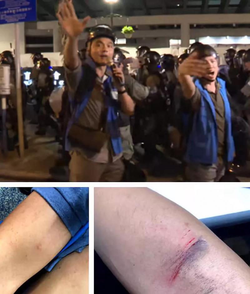 港警中箭,中箭蓝衣