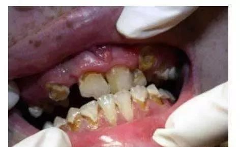 禁毒知识毒品的危害答案,禁毒知识资料毒品的危害