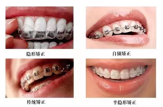 鍠滃ぇ鏅鏈夊暐浼樻儬,鍠滃ぇ鏅浼樻儬