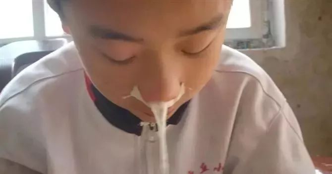 儿童鼻痒鼻塞鼻炎用什么喷剂,鼻腔缓解喷雾