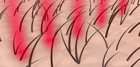 现在市场上脱发育发露有效果吗,防脱育发露对雄激素脱发有效果吗