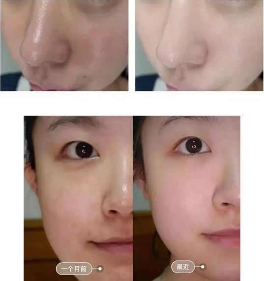 新西兰好用面霜,新西兰本土面霜怎么样好用吗