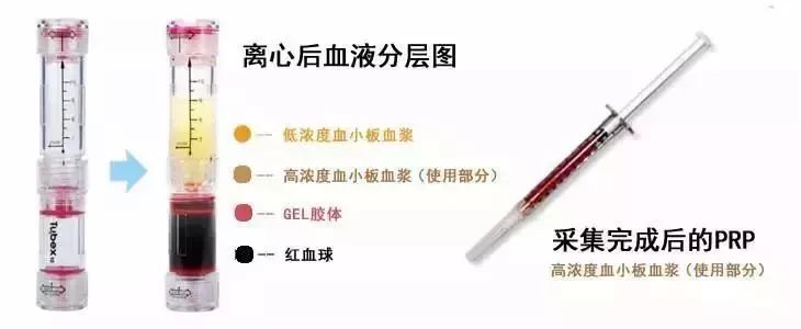 关节炎医院网上挂号,市中医院治疗关节炎