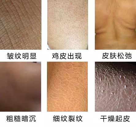 澳洲绵羊油娇嫩补水保湿霜,澳洲高颜值绵羊油