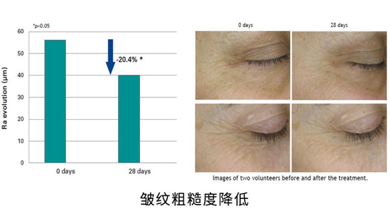 韩国品牌眼霜补水保湿,推荐一款韩国好用的眼霜