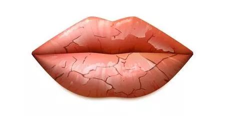 唇部起皮推荐唇膏,嘴唇干起皮的最好唇膏
