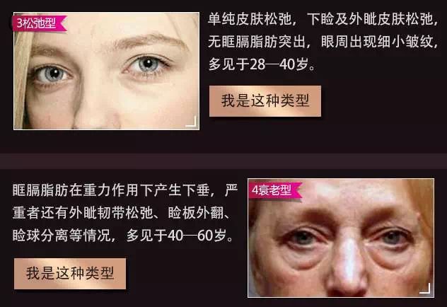 马应龙八宝眼袋型眼膜,马应龙八宝多肽眼膜