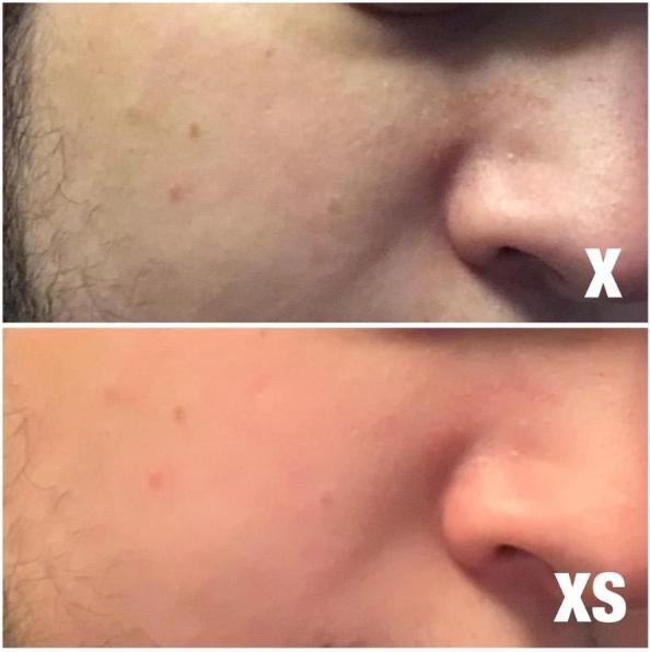 iphonexs自拍不清晰,ios12.0苹果xs