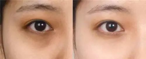 蒸汽抗疲劳缓解黑眼圈眼罩,泰国草本蒸汽眼罩