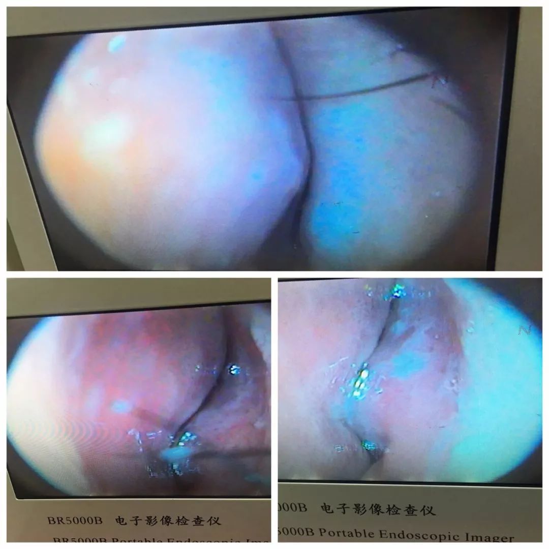 四退原则出炉：“无论什么原因，鼻炎治不好就退款！”常州这家诊所打了谁的脸？