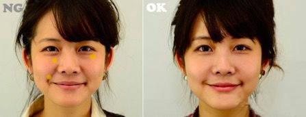 微晶法令纹贴抗皱纹提拉紧致面膜,淡纹抗皱法令纹面膜推荐