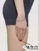 胃疼便秘出血怎么办,胃强脾弱磨牙流鼻血便秘