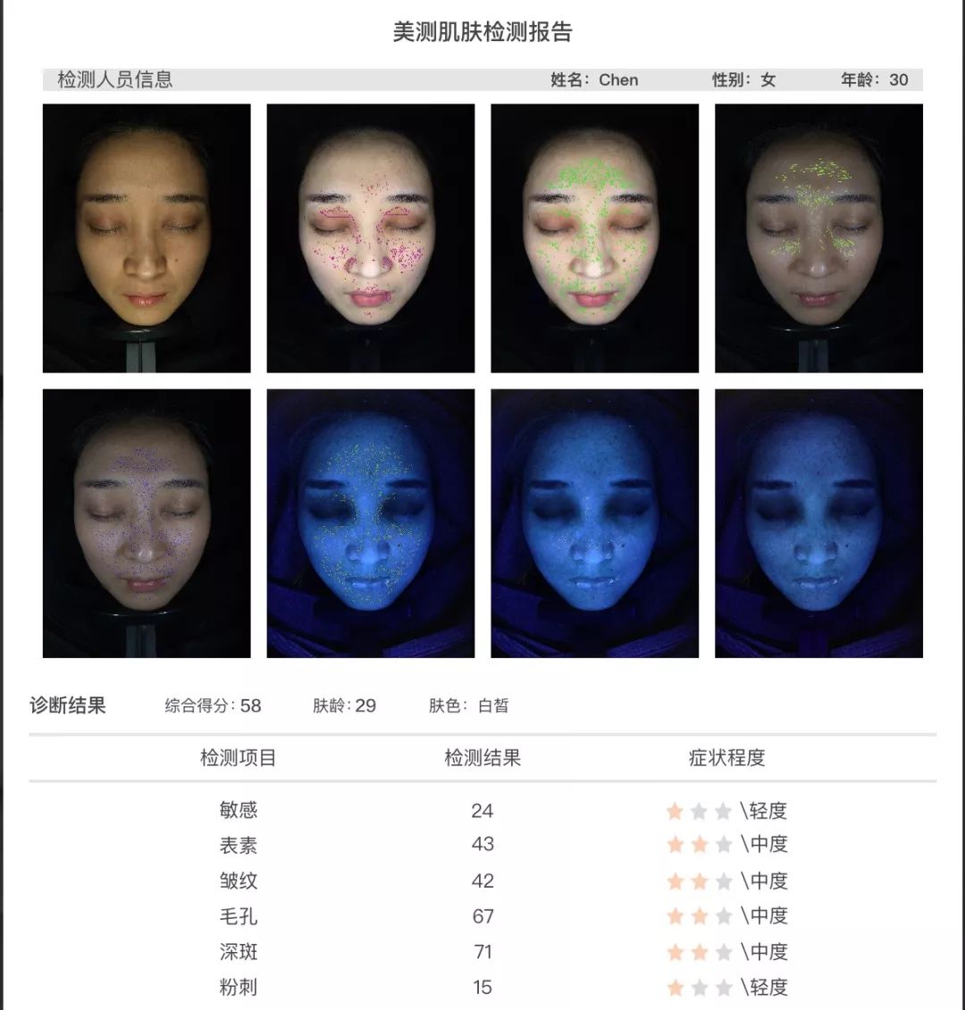 灏忚寕鑲岃瘖瀹ゅ埌搴曟湁澶氬己,灏忚寕鑲岃瘖瀹よˉ姘村悧