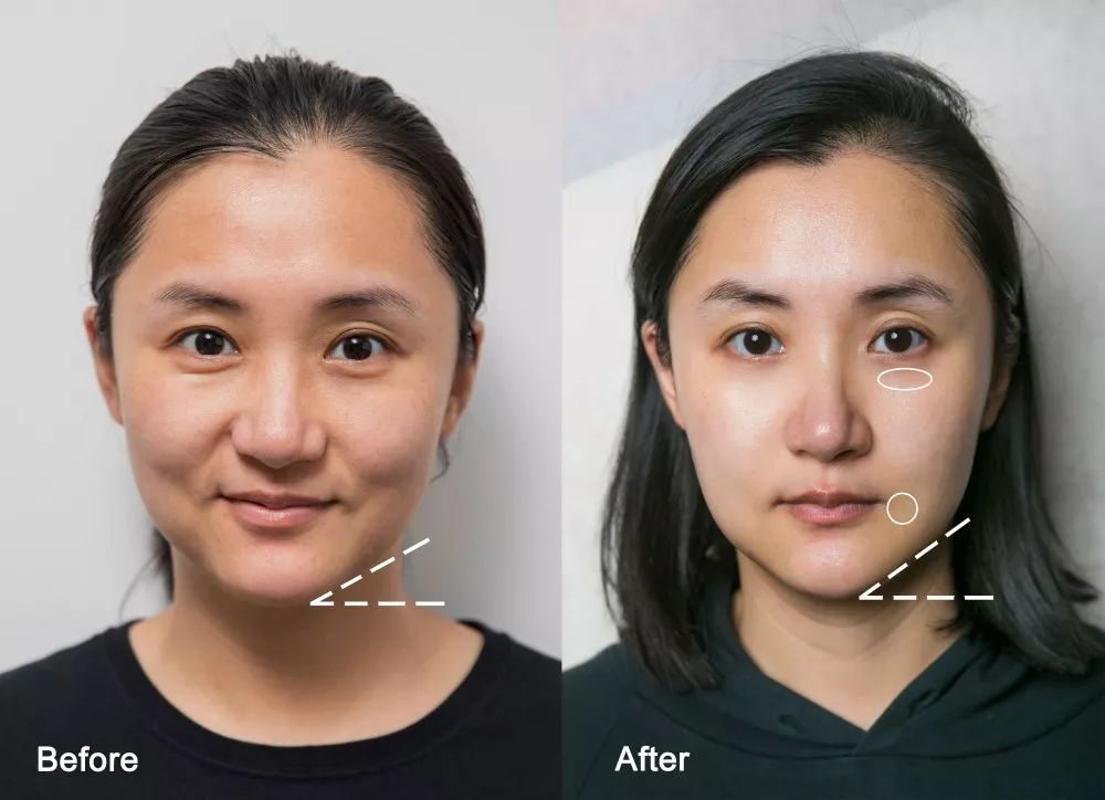 灏忚寕鑲岃瘖瀹ゅ埌搴曟湁澶氬己,灏忚寕鑲岃瘖瀹よˉ姘村悧