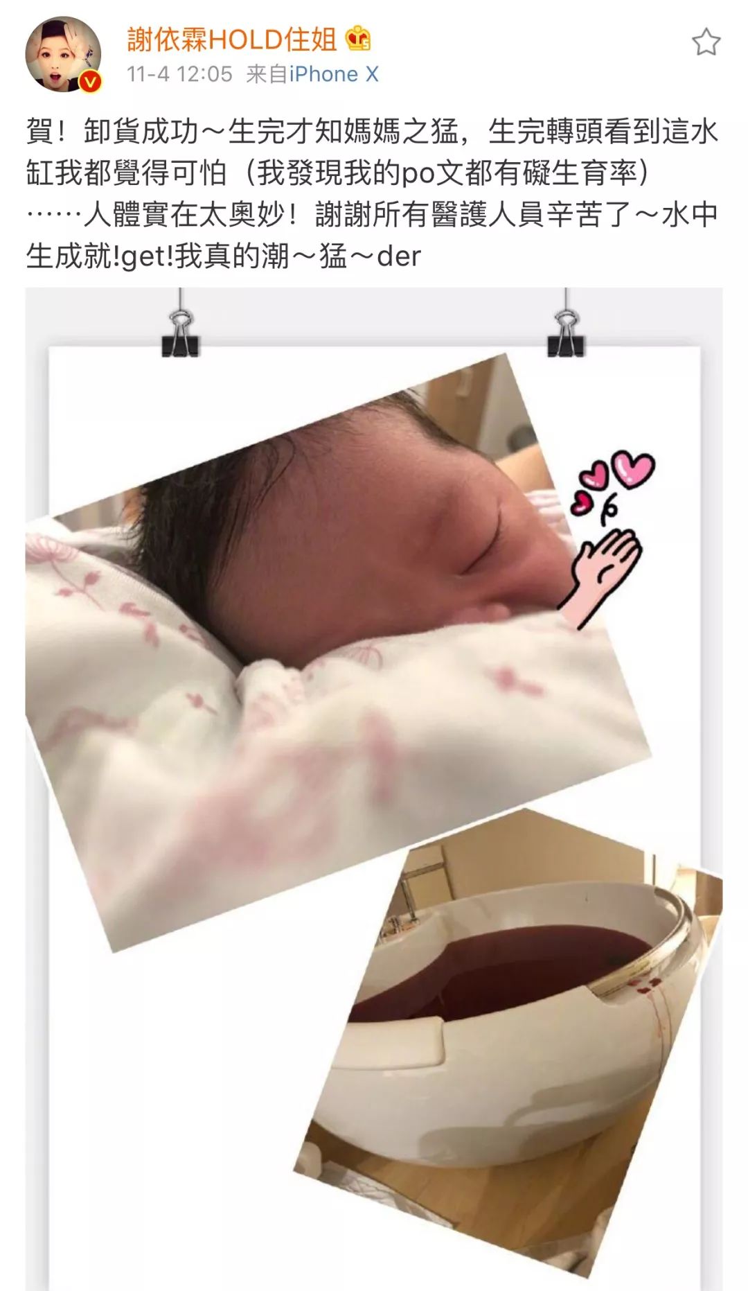 谢依霖怀孕晒b超照散发母爱光环,谢依霖讲述水中分娩