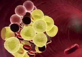 转氨酶升高中药怎样治疗,转氨酶升高中医治疗