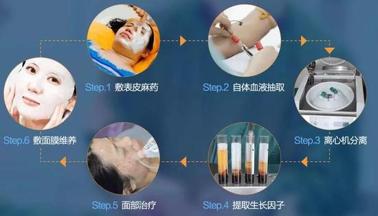 干细胞医美是骗局吗,干细胞护肤是骗局揭秘