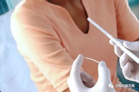 女性避孕技术,医学最安全最有效的避孕方式