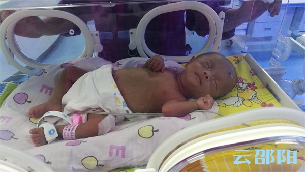 一产妇诞下“巨型”婴儿,19岁产妇产下婴儿