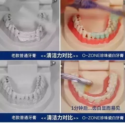 一刷就白的网红牙膏是真的假的,自从换了牙就牙黄