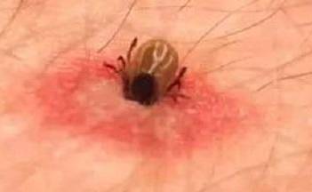 警惕这小虫,六安已有人因它致死!当下高发期!