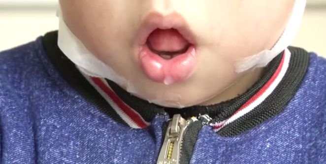 小孩子8岁了嘴巴合不拢,5岁小孩经常心疼怎么回事