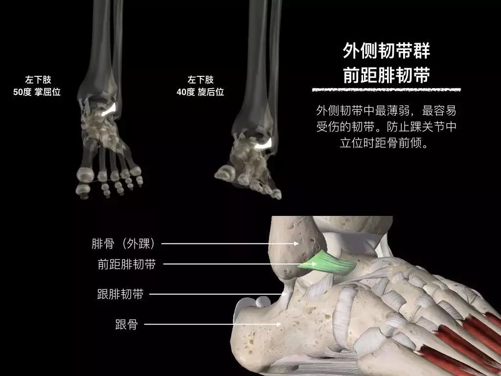 踝关节韧带修复手术康复动作,踝关节韧带康复训练图解