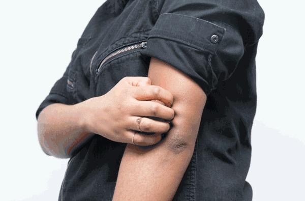 冬春季节皮肤干燥用什么护肤品,吃什么冬季皮肤不干燥