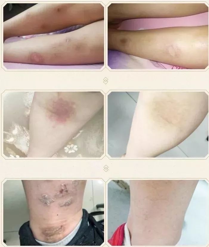 清凉止痒防暑醒神膏,止痒的草药膏