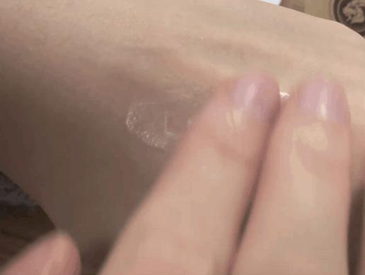 脱发算啥!90后已经开始长“老年斑”了,有人还为此花了10多万!