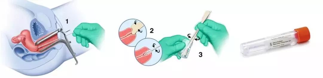 为何hpv疫苗预约都没号,hpv疫苗一年预约超过两次该怎么办