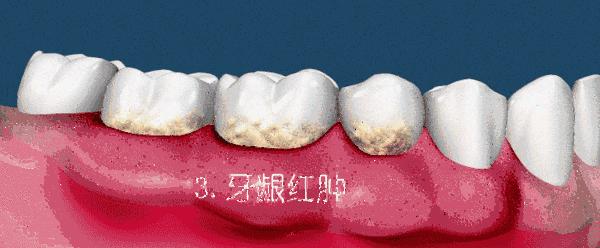 记忆手柄牙刷，刷新想象！1支=5支普通牙刷+1瓶漱口水+1瓶口香糖