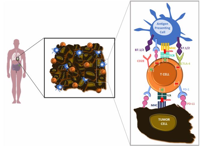 「我们都被结果惊呆了」：免疫新辅助治疗，正在改写早期肺癌的治疗现状，这无疑也是中国临床的新机遇丨奇点搜神记