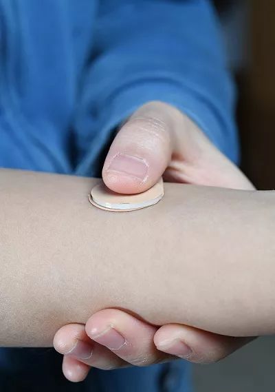 避孕帽避孕贴片,避孕贴片一片能避孕多久