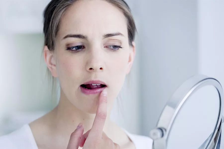 唇干唇裂涂唇膏会去死皮吗,唇裂唇干起皮修复唇膏儿童