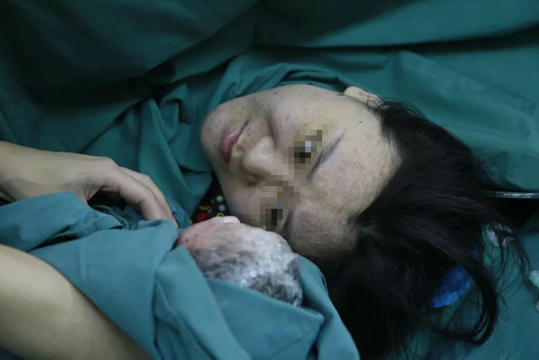 中国首例子宫移植女人顺利分娩,中国首例试管婴儿生下第二代宝宝