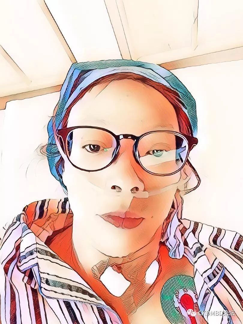 甲状旁腺射频消融术的全过程,后悔做甲状旁腺射频消融