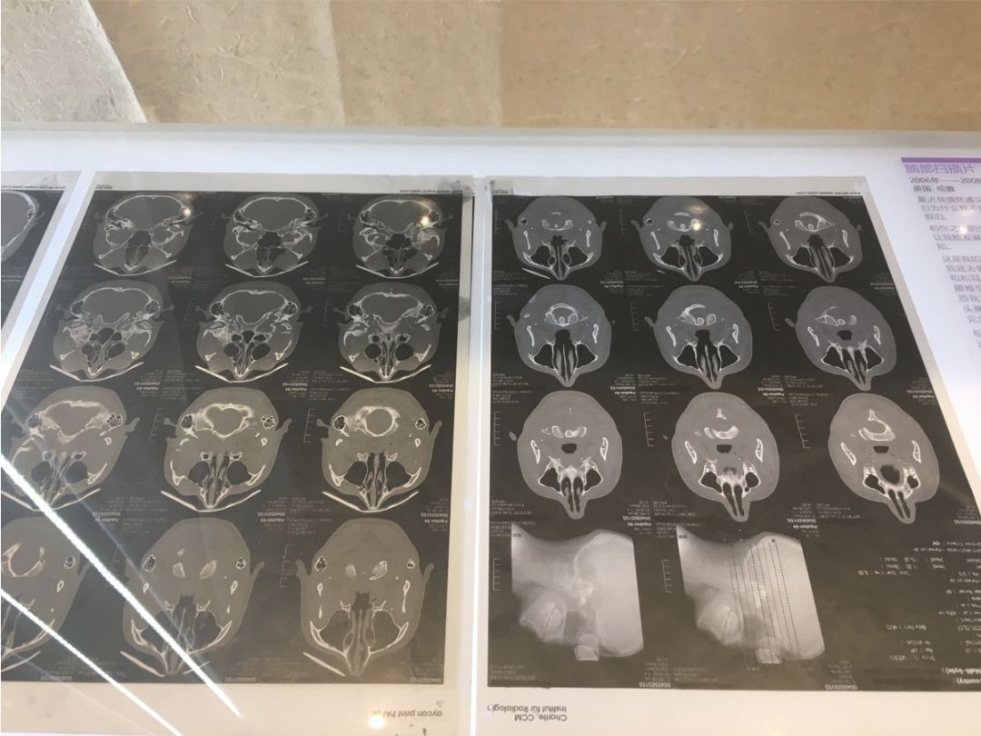 你有爱的恋物癖么？