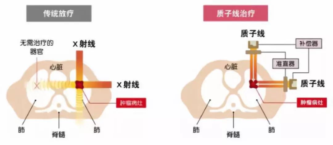 关注｜你知道吗？核技术在癌症治疗的应用中有很大突破！