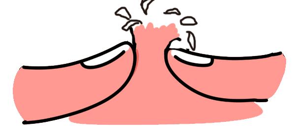 药师讲痘痘视频,药师说痘痘