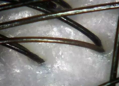 3天不洗头头皮特别多,3天不洗头头皮好臭