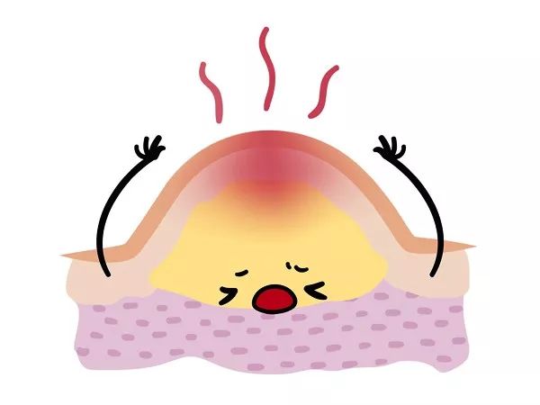 过年胡吃海喝长的痘,怎么急救?