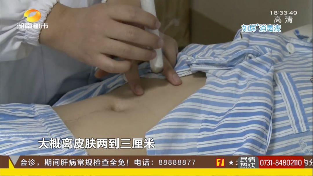 春节期间，男子只顾连日“潇洒”，身体这个部分撑不住了……