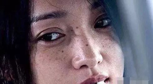 淡化痘印和斑点比较好的产品,美白淡化痘印产品真实测评