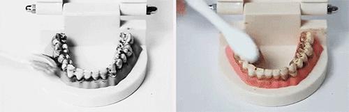 去除黄牙牙垢的牙膏,去口臭黄牙牙垢的牙膏