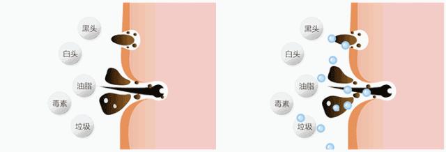 用了几天火山泥为什么还毛孔粗大,怎样用韩国进口火山泥洗脸