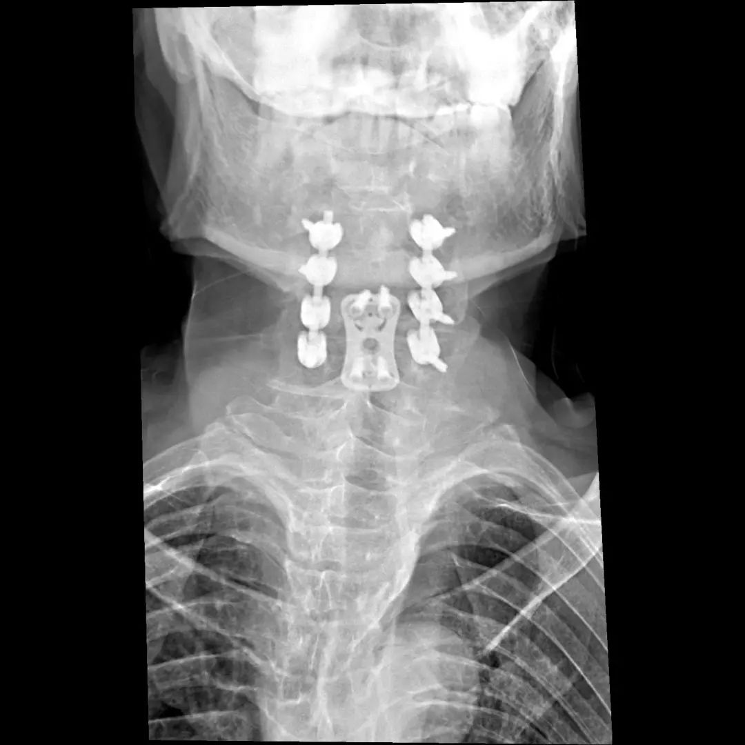 鍕囬棷鐢熷懡绂佸尯鍖婚櫌,鍕囬棷鐢熷懡绂佸尯浜旀鍙仠鎵嬫湳