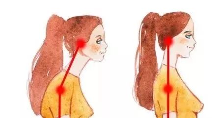 明星颈前倾的矫正方法,脖子前倾的明星有哪些