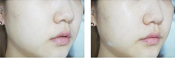 胶原蛋白怎么补吃什么,胶原蛋白怎么补才能吸收得好