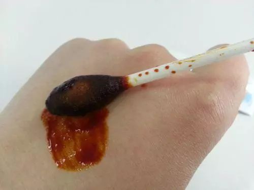 女儿摔破了头流血怎么办,女儿摔破头了我很自责